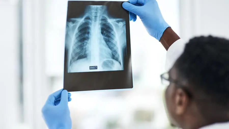 X-ray imaging service in Kingston Jamaica at PRIME Medical